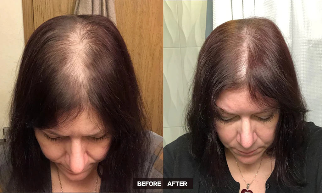 JUMBO Scalp Stimulator