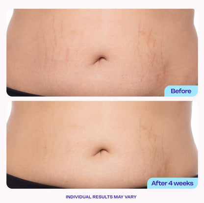 GOPORE Belly Cream for Firmer, Smoother Skin