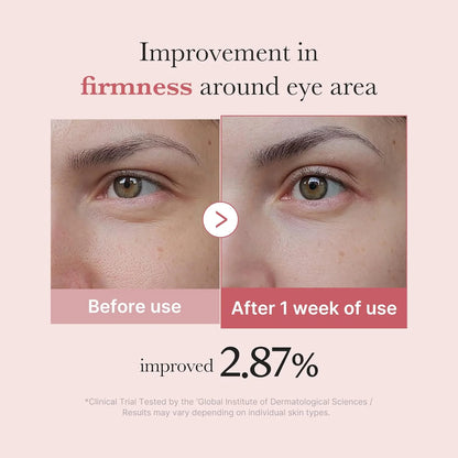 PDRN Pink Caffeine Collagen Eye Patch for Night CareㅣFuller-Looking Eye Area, Under-Eye Puffiness