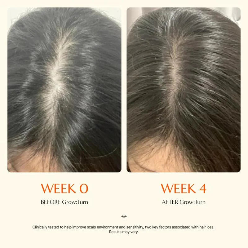 Grow turn Hair Growth Serum with Built in Brush for Hair Growth & Thickening