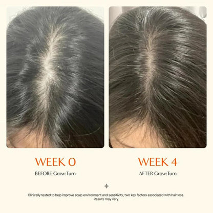 Grow turn Hair Growth Serum with Built in Brush for Hair Growth & Thickening