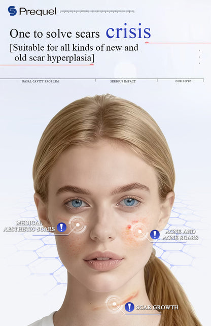 SCAR SOLUTIONS SILICONE SCAR STICK