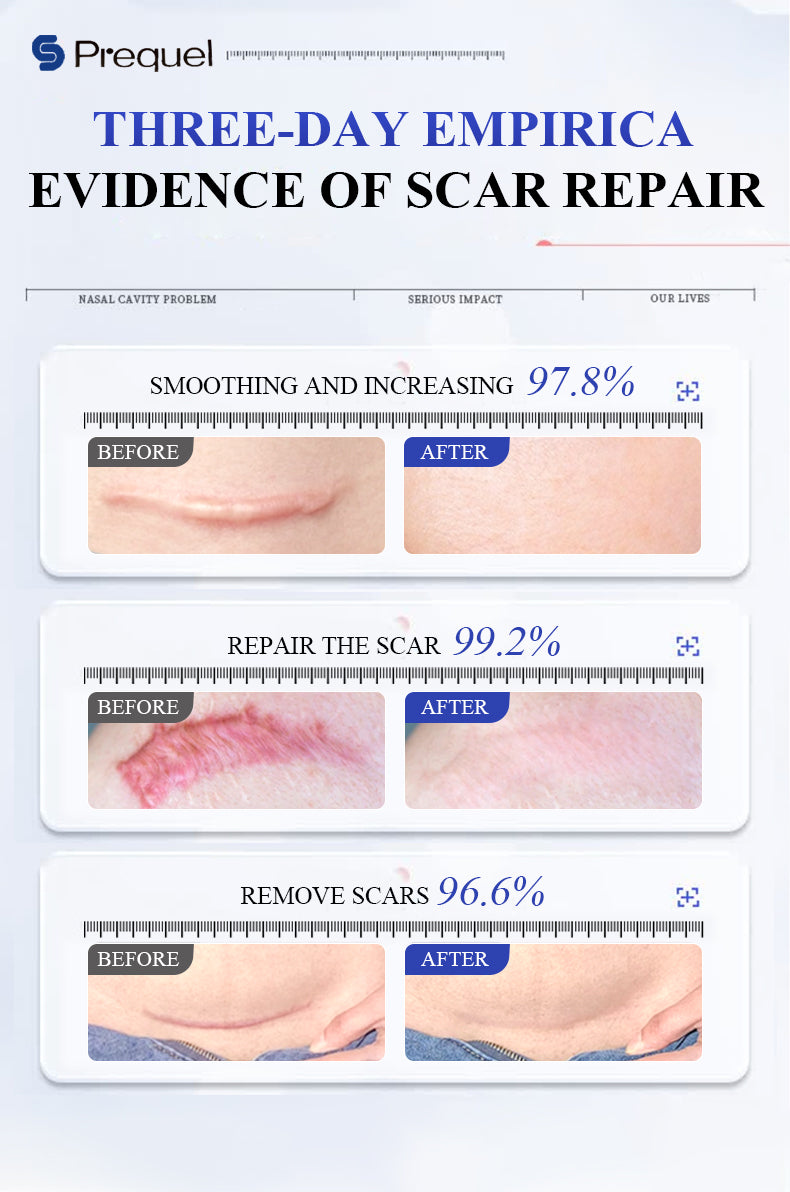 SCAR SOLUTIONS SILICONE SCAR STICK