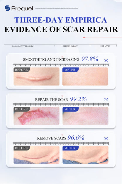 SCAR SOLUTIONS SILICONE SCAR STICK