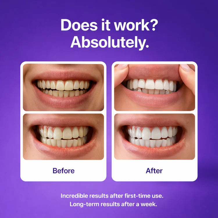 DRDENT Purple Teeth Whitening Strips - 21 Whitening Sessions - Safe for Enamel - Non Sensitive Teeth Whitening