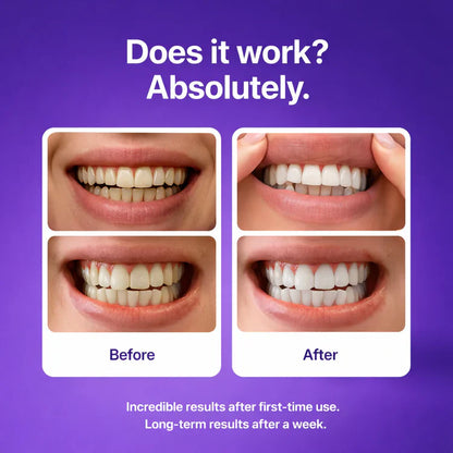DRDENT Purple Teeth Whitening Strips - 21 Whitening Sessions - Safe for Enamel - Non Sensitive Teeth Whitening