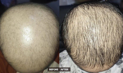 JUMBO Scalp Stimulator
