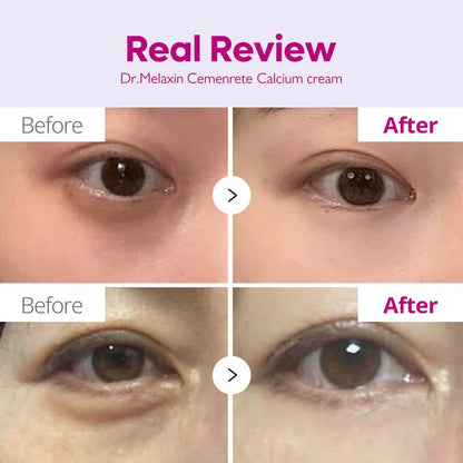 ✨ Cemenrete Calcium Dark Spot Eye Cream | Dark Circle, Anti-aging, Sagging, Elasticity  ✨