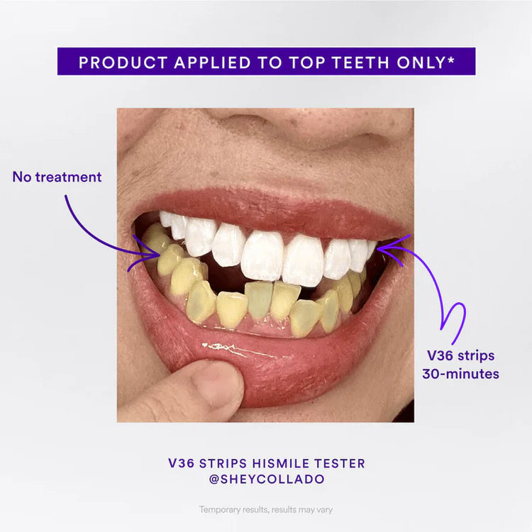 Final 3 Hours: 60%OFF🔥Clinclii™Whitening Strips – Professional Teeth Whitening at Home