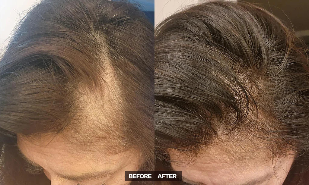 JUMBO Scalp Stimulator
